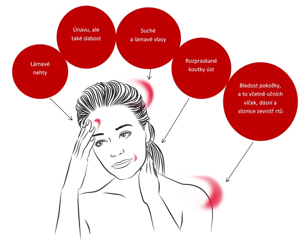 Jak poznáte nedostatek železa